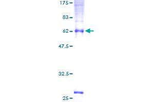 Image no. 1 for Transmembrane Protein 59 (TMEM59) (AA 1-300) protein (GST tag) (ABIN1323036) (TMEM59 Protein (AA 1-300) (GST tag))