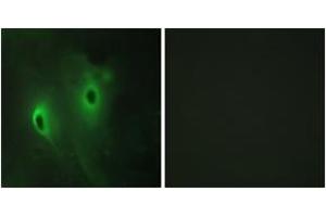 Immunofluorescence analysis of HeLa cells, using DUSP9 Antibody. (DUSP9 Antikörper  (AA 151-200))