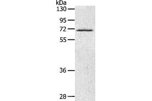 Western blot analysis of Human fetal brain tissue, using LTA4H Polyclonal Antibody at dilution of 1:500 (LTA4H Antikörper)