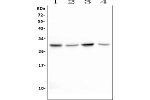 Western blot analysis of EPO using anti-EPO antibody (ABIN6719435). (EPO Antikörper  (AA 28-193))