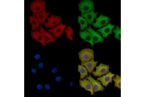 ABIN7093777 and ABIN7097818 staining HepG2 cells by IF/ICC. (IL-1 beta Antikörper)