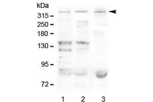 Western blot testing of Dystrophin antibody and Lane 1:  human SMMC-7721 (Dystrophin Antikörper  (AA 3076-3404))