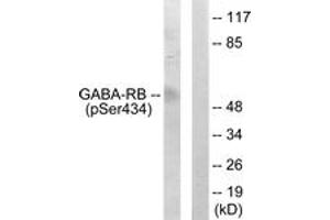 Western blot analysis of extracts from COS7 cells, using GABA-RB (Phospho-Ser434) Antibody. (GABA-RB (AA 401-450), (pSer434) Antikörper)