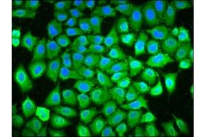 Immunofluorescence staining of Hela cells with ABIN7163852 at 1:133, counter-stained with DAPI.