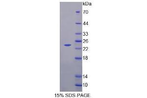 Image no. 1 for Neurocalcin delta (NCALD) (AA 2-193) protein (His tag) (ABIN6239718)