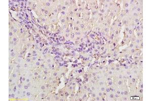 Immunohistochemistry (IHC) image for anti-Mannan-Binding Lectin serine Peptidase 2 (MASP2) (AA 351-450) antibody (ABIN676223)