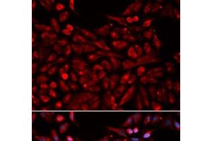 Immunofluorescence analysis of U2OS cells using NR1I3 Polyclonal Antibody (NR1I3 Antikörper)
