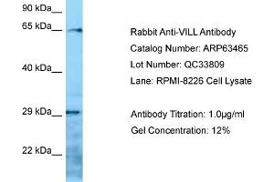 Western Blotting (WB) image for anti-Villin-Like (VILL) (N-Term) antibody (ABIN2789509) (VILL Antikörper  (N-Term))