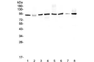 Western blot testing of human 1) HeLa 2) placenta, 3) MCF7, 4) A549, 5) SK-OV-3, 6) 22RV1, 7) A431 and 8) COLO320 lysate with UBA2 antibody at 0. (UBA2 Antikörper)