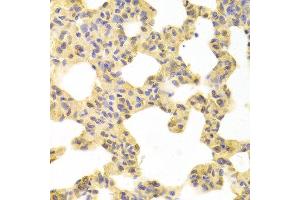 Immunohistochemistry (IHC) image for anti-Mitogen-Activated Protein Kinase Kinase 1 (MAP2K1) (AA 1-100) antibody (ABIN3020794)