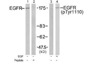 Image no. 1 for anti-Epidermal Growth Factor Receptor (EGFR) (pTyr1110) antibody (ABIN197027) (EGFR Antikörper  (pTyr1110))