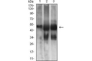 Western blot analysis using TUBB3 mouse mAb against NIH/3T3 (1), Hela (2), and A549 (3) cell lysate. (TUBB3 Antikörper)