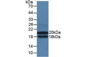 Western blot analysis of recombinant Mouse IL3Ra. (IL3RA Antikörper  (AA 167-331))