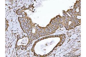 IHC analysis of ECHS1 using anti-ECHS1 antibody (ABIN7599813).