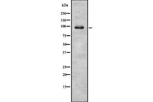 Western blot analysis of RASA2 expression in HEK293 cells ,The lane on the left is treated with the antigen-specific peptide. (RASA2 Antikörper  (C-Term))
