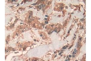 Immunohistochemistry (IHC) image for anti-Prohibitin (PHB) (AA 177-272) antibody (ABIN7431794)