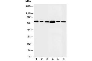 Western blot testing of FAF1 antibody and Lane 1:  rat testis;  2: MM453;  3: MM231;  4: HeLa;  5: SMMC-7721;  6: SW620 (FAF1 Antikörper  (N-Term))