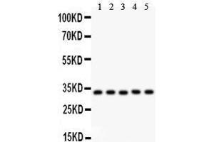 Western Blotting (WB) image for anti-Heme Oxygenase (Decycling) 1 (HMOX1) (AA 1-288) antibody (ABIN3042449)