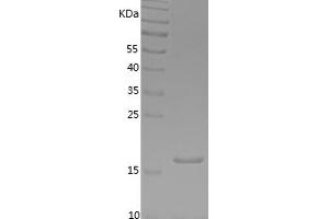 Western Blotting (WB) image for Interferon gamma (IFNG) (AA 24-166) protein (His tag) (ABIN7123489) (Interferon gamma Protein (IFNG) (AA 24-166) (His tag))