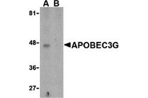 Western Blotting (WB) image for anti-Apolipoprotein B mRNA Editing Enzyme, Catalytic Polypeptide-Like 3G (APOBEC3G) (N-Term) antibody (ABIN1031236) (APOBEC3G Antikörper  (N-Term))