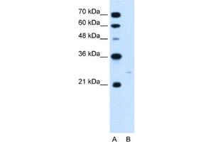 Western Blotting (WB) image for anti-MAX Interactor 1 (MXI1) antibody (ABIN2460213) (MXI1 Antikörper)