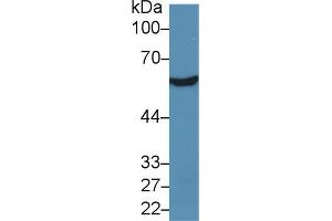 Western blot analysis of Rat Liver lysate, using Human ALDH7A1 Antibody (5 µg/ml) and HRP-conjugated Goat Anti-Rabbit antibody ( (ALDH7A1 Antikörper  (AA 1-539))