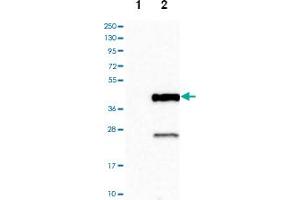 Western blot analysis of Lane 1: Negative control (vector only transfected HEK293T lysate), Lane 2: Over-expression lysate (Co-expressed with a C-terminal myc-DDK tag (~3. (Cathepsin S Antikörper)
