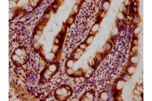 Immunohistochemical of paraffin-embedded human small intestinal tissue using ABIN7153439 at dilution of 1:100 (Galectin 3 Antikörper)