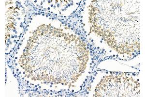 ABIN6265738 and ABIN6266686 at 1/100 staining Rat testis tissue by IHC-P. (TRIM38 Antikörper  (Internal Region))
