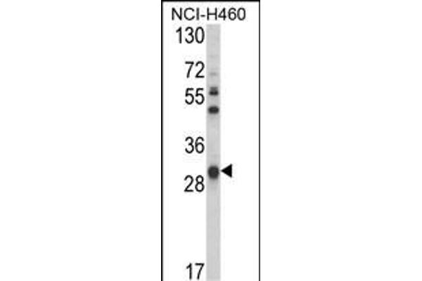 GSTO1 Antikörper  (AA 126-155)