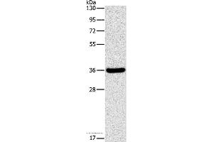 Western blot analysis of Human fetal liver tissue, using FGL1 Polyclonal Antibody at dilution of 1:1050 (FGL1 Antikörper)