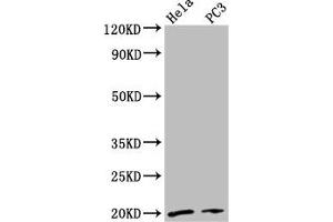 Western Blot Positive WB detected in: Hela whole cell lysate, PC-3 whole cell lysate All lanes: NDUFAF2 antibody at 2. (NDUFAF2 Antikörper  (AA 117-169))
