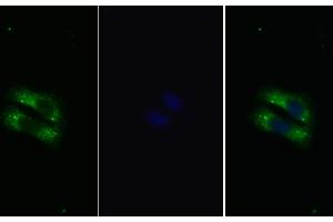Detection of IL22R in Human HepG2 cell using Polyclonal Antibody to Interleukin 22 Receptor (IL22R) (IL22R Antikörper  (AA 267-565))