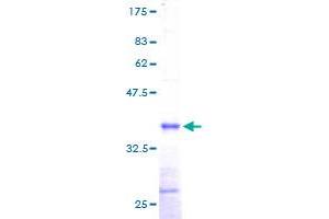 DAD1 Protein (AA 1-113) (GST tag)