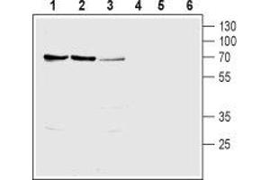 Western blot analysis of rat kidney (lanes 1 and 4), rat liver (lanes 2 and 5) and mouse kidney (lanes 3 and 6) lysates: - 1-3. (SLC28A1 Antikörper  (Intracellular, N-Term))
