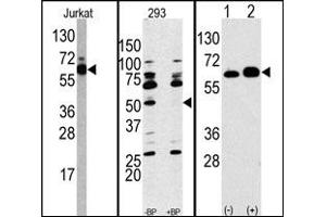 Image no. 1 for anti-Ribosomal Protein S6 Kinase, 70kDa, Polypeptide 1 (RPS6KB1) (Middle Region) antibody (ABIN358256) (RPS6KB1 Antikörper  (Middle Region))