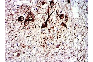 Immunohistochemical analysis of paraffin-embedded medulla oblongata tissues using TUBA8 mouse mAb with DAB staining. (TUBA8 Antikörper)