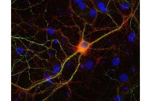 Indirect immunostaining of PFA fixed rat hippocampus neurons with anti-NSF (dilution 1 : 500; red) and mouse anti-MAP 2 (, dilution 1 : 1000; green).