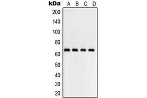 Western blot analysis of NF-kappaB p65 expression in HepG2 (A), MCF7 (B), Raw264. (NF-kB p65 Antikörper  (Center))
