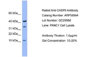 WB Suggested Anti-CASP6  Antibody Titration: 0. (Caspase 6 Antikörper  (Middle Region))