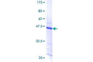 TPD52L1 Protein (AA 1-144) (GST tag)