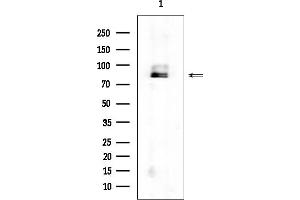 anti-N-Acylaminoacyl-Peptide Hydrolase (APEH) antibody