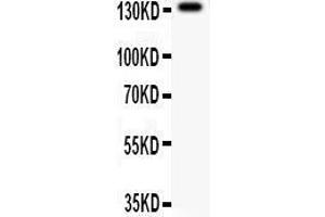 Anti- NMDAR2C Picoband antibody, Western blotting All lanes: Anti NMDAR2C  at 0. (GRIN2C Antikörper  (AA 43-242))