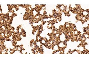 Immunohistochemistry (IHC) image for anti-Lectin, Galactoside-Binding, Soluble, 1 (LGALS1) (AA 1-135) antibody (ABIN7431629)
