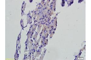 Formalin-fixed and paraffin embedded rat pancreas tissue labeled with Anti-FAF1 Polyclonal Antibody, Unconjugated (ABIN675309) followed by conjugation to the secondary antibody and DAB staining (FAF1 Antikörper  (AA 551-650))