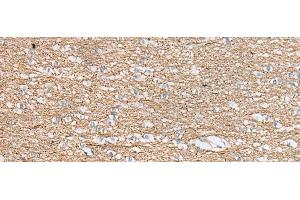 Immunohistochemistry of paraffin-embedded Human brain tissue using IDO2 Polyclonal Antibody at dilution of 1:45(x200) (IDO2 Antikörper)