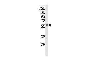 Western blot analysis of ALDH3B1 Antibody (Center) (ABIN652651 and ABIN2842437) in MDA-M cell line lysates (35 μg/lane). (ALDH3B1 Antikörper  (AA 334-360))