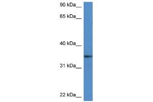 WB Suggested Anti-Dhrs3 Antibody   Titration: 1. (DHRS3 Antikörper  (Middle Region))