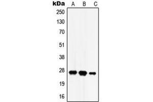 Western blot analysis of HADH2 expression in SKNSH (A), HEK293T (B), rat brain (C) whole cell lysates.