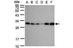 WB Image Sample(30 ug whole cell lysate) A: 293T B: A431 , C: H1299 D: HeLa S3 , E: Hep G2 , F: Raji , 12% SDS PAGE antibody diluted at 1:1000 (AK4 Antikörper)
